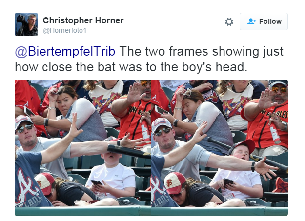 Dad's Quick Thinking Saves Little Boy's Face at Baseball Game - ABC News